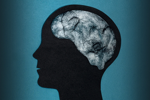brain-fog