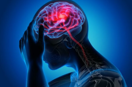 stroke dan demensia