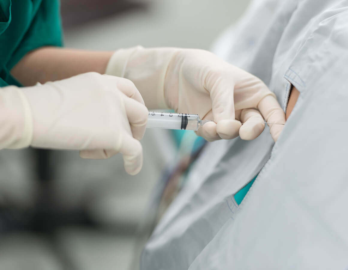 epidural steroid injection
