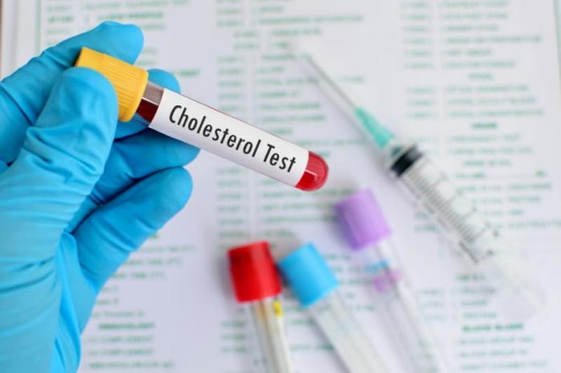 kolesterol tinggi sebabkan stroke