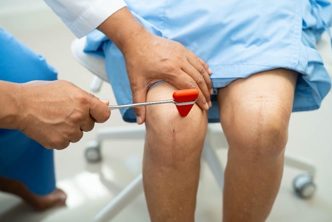 arthroplasty
